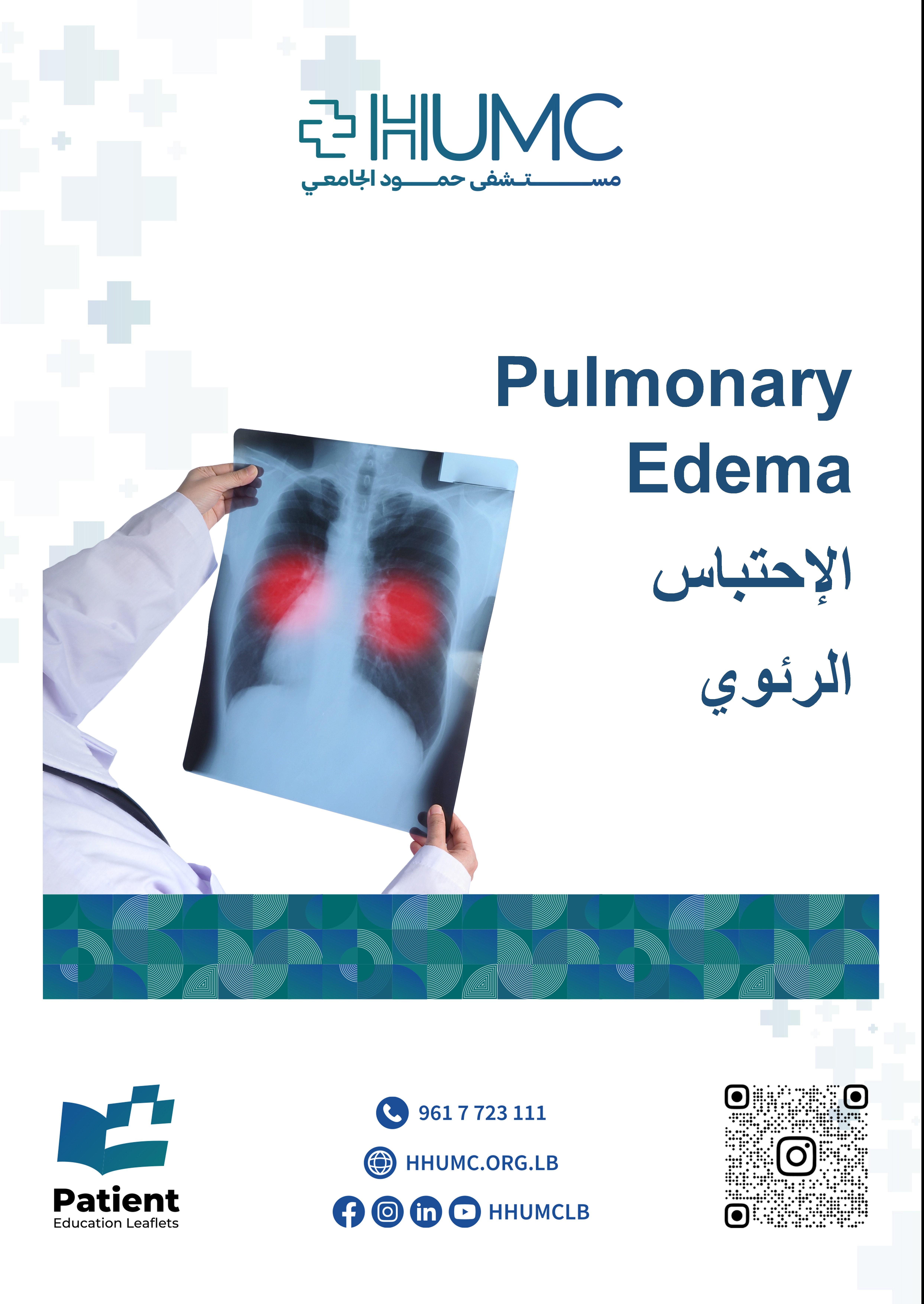 Pulmonary Edema